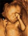 preborn baby 4-D
